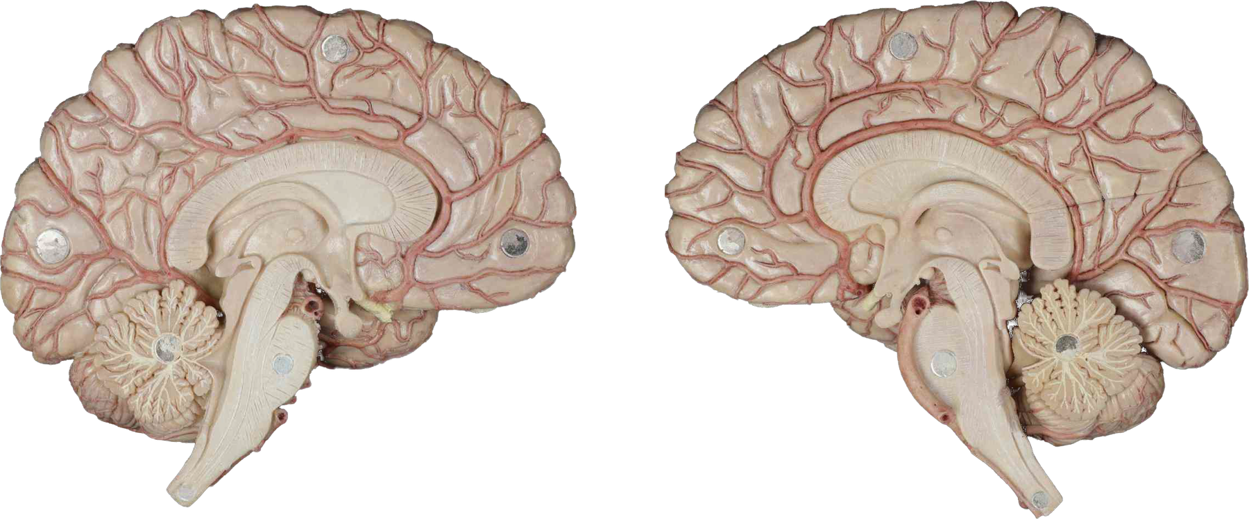 Cérebro e artérias cerebrais em modelo anatômico de alta fidelidade