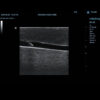 Simulador de acesso venoso jugular guiado por ultrassom