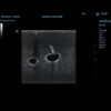 Simulador de acesso venoso jugular guiado por ultrassom